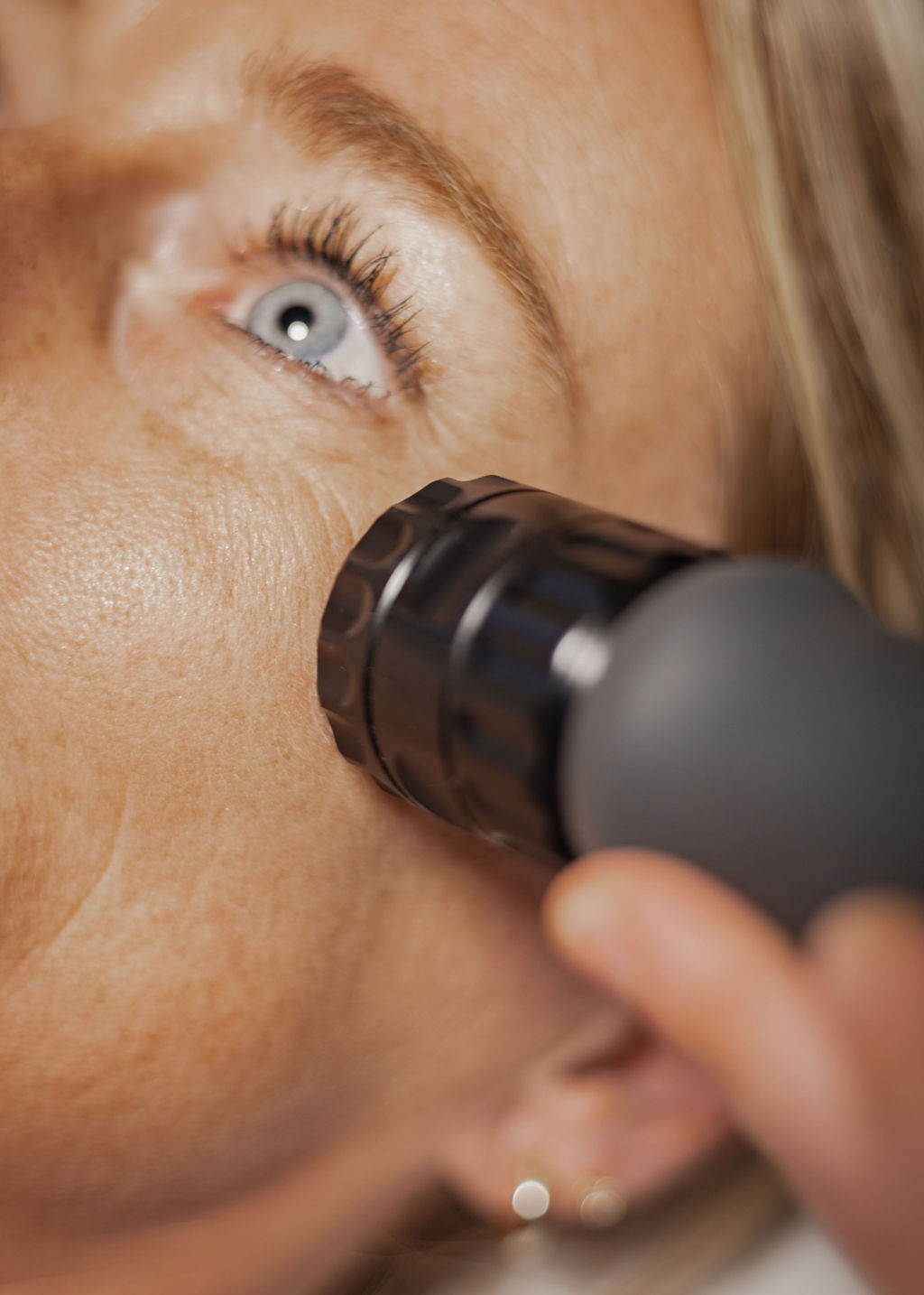 radierende shockwave